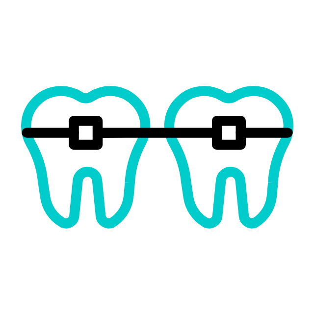 Decorative braces animation